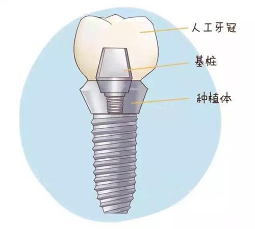  data-cke-saved-src=http_%2F%2Fwww.boai6666.com%2Fuploads%2Fallimg%2F191108%2F1-19110pqf23f.jpg&refer=http_%2F%2Fwww.boai6666.jpg src=http_%2F%2Fwww.boai6666.com%2Fuploads%2Fallimg%2F191108%2F1-19110pqf23f.jpg&refer=http_%2F%2Fwww.boai6666.jpg