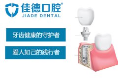 合肥佳德口腔靠谱么-来自牙友的分享