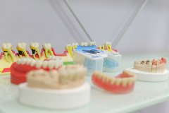 合肥种植牙齿一颗多少钱-2021年种牙价格表