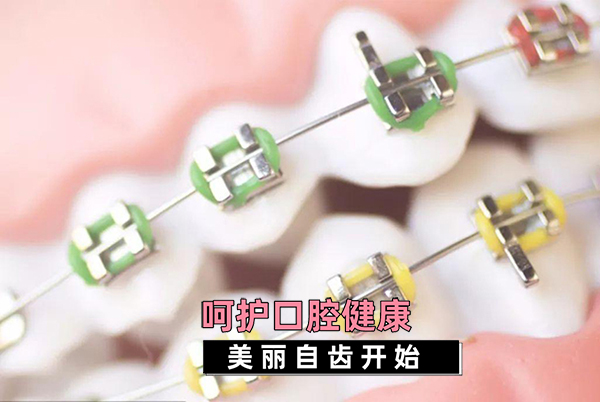 合肥牙齿矫正建议
