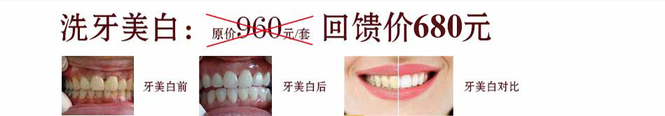 牙齿美白