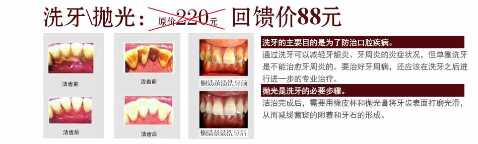 牙齿修复