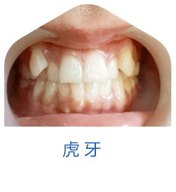 虎牙