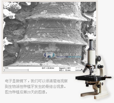 骨结合技术